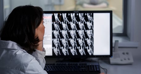 Inteligência artificial na radiologia: aplicações na interpretação de imagens