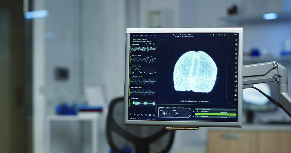 inteligencia-artificial-radiologia