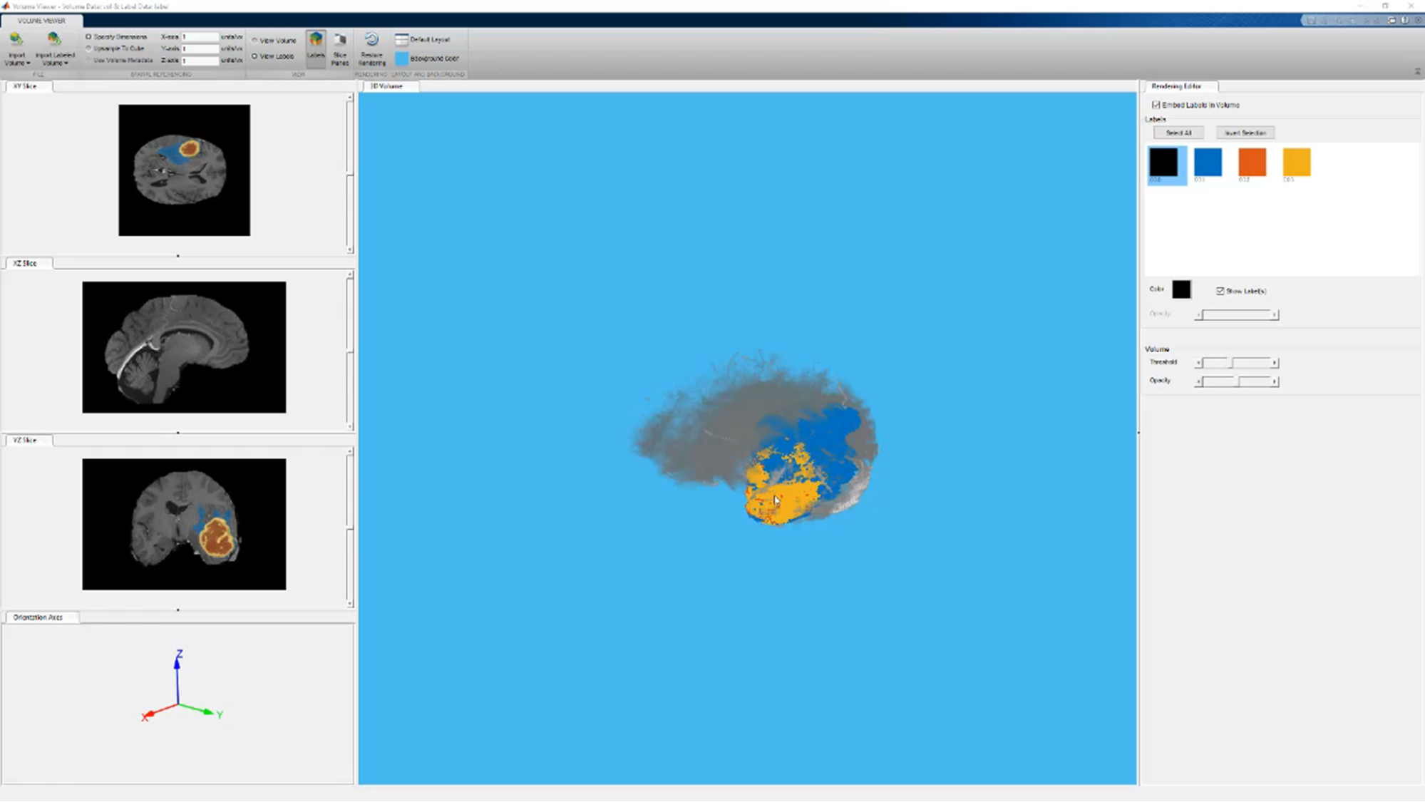 matlab-ia-monitoramento-pacientes