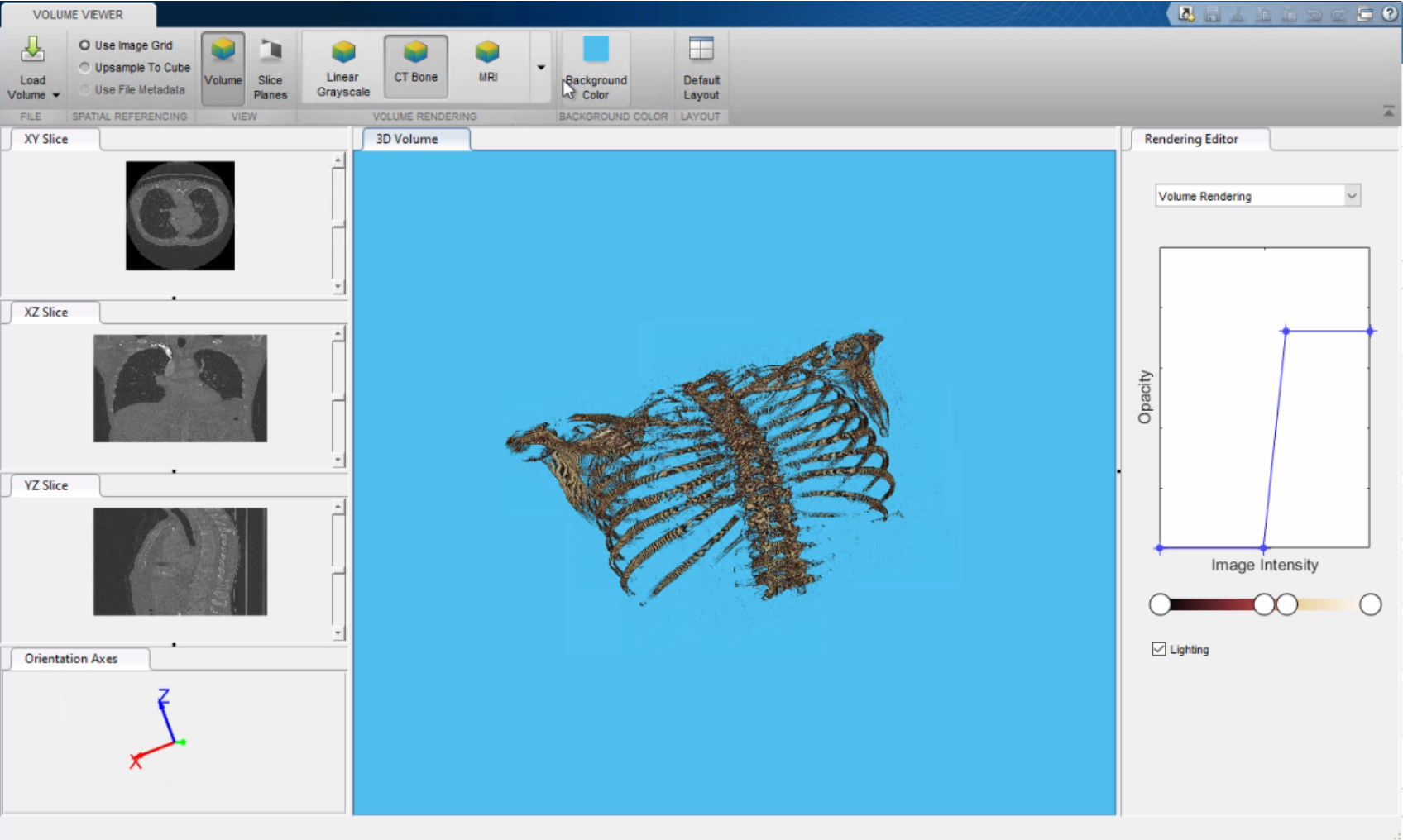 matlab-simulink-radiologia